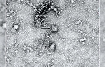 コロナウイルス三重県感染者は何人で病院はどこか調査！